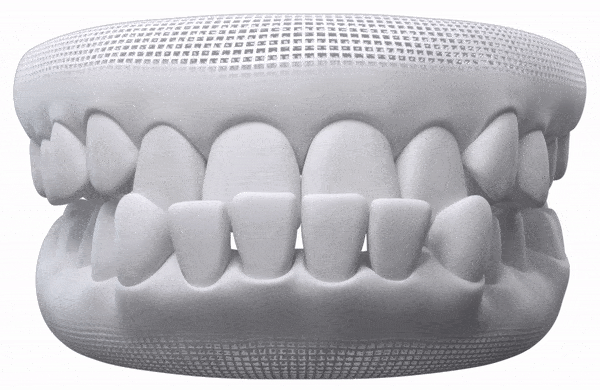 How does Invisalign Work?